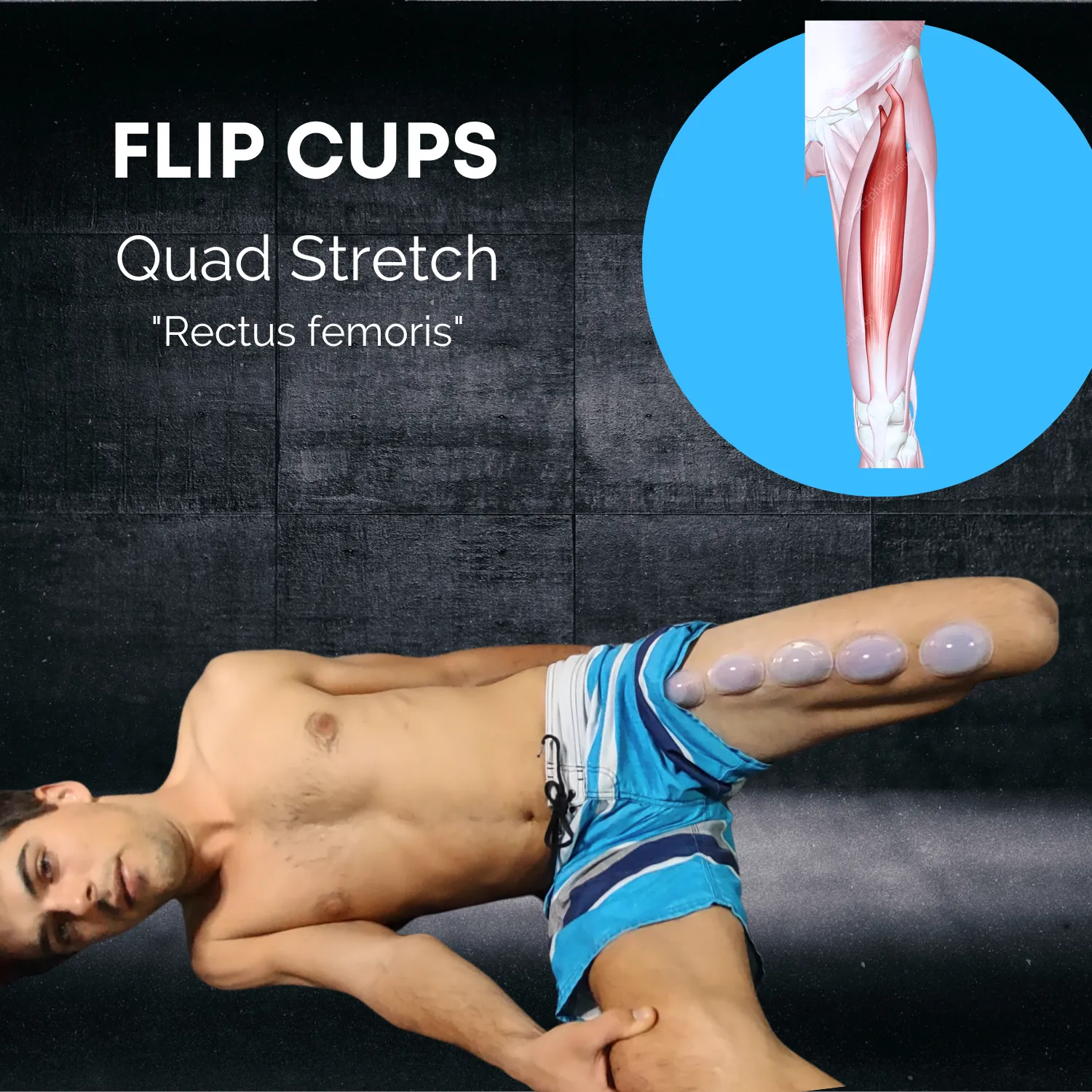 Flip Cups™ Pain Relief & Stretching Cupping Therapy Body Cups